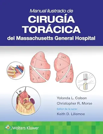 Manual ilustrado de Cirugía torácica del Massachusetts General Hospital (Spanish Edition) - E-Book - PDF