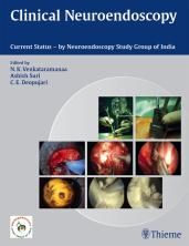 Clinical Neuroendoscopy(Monograph) - E-Book - Original PDF