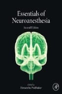 Essentials of Neuroanesthesia - E-Book - PDF